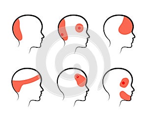 Types of headaches on a white background. Silhouette. Vector